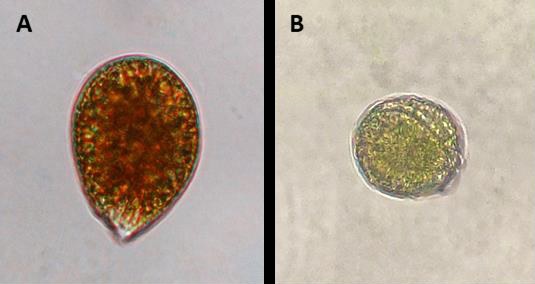 Algas tóxica bentónicas vistas por un microscopio