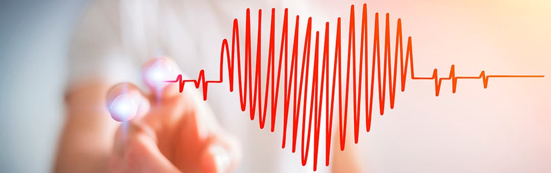 Imagen coraz&oacute;n