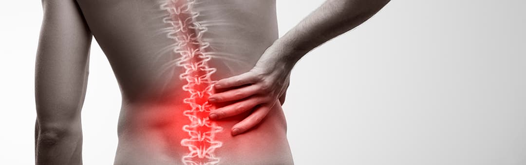 Imagen dolor de espalda