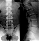 Imagen radiograf&iacute;a