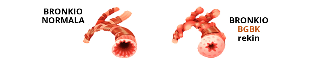 Bronkio bat BGBK-rekin eta BGBK-rik gabe