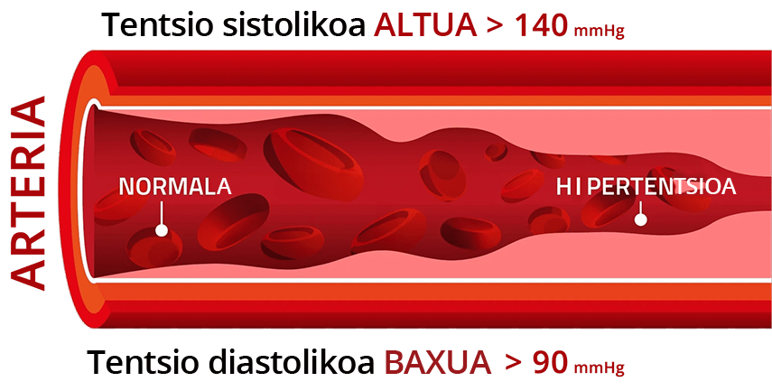 Imagen arteria con hipertensión