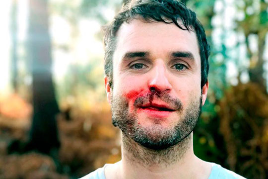 MOXAL + HANNES BUDER